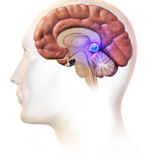 Активация шишковидной железы